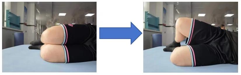 髋关节训练椅_髋关节置换术后康复训练_湖南省直中医医院康复训练方法