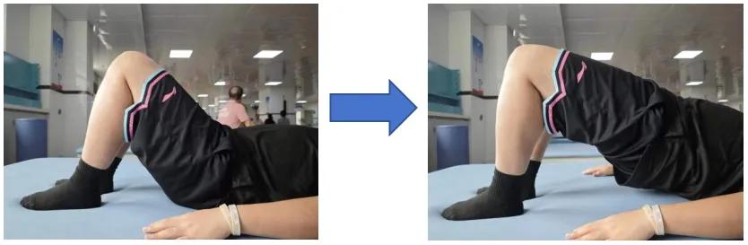 髋关节置换术后康复训练_髋关节训练椅_湖南省直中医医院康复训练方法