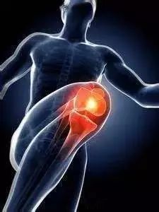 膝关节骨性关节炎发生机制_股四头肌训练椅_骨关节炎康复训练