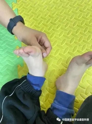 感统训练单腿椅_感觉统合训练方法_儿童感觉统合游戏大全