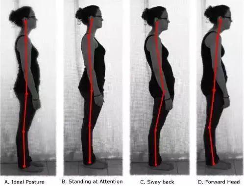 博恩斯摇摆椅_髋关节训练椅_腰椎稳定性训练
