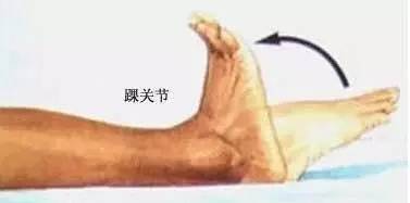 髋关节置换术适应症 _ 人工关节置换术前准备 _髋关节训练椅