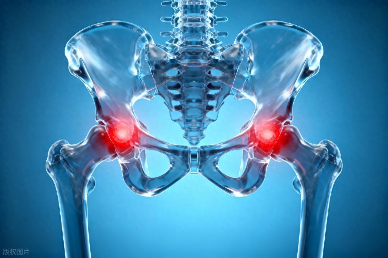髋关节卡顿_髋关节活动异常与退变关系_髋关节训练椅
