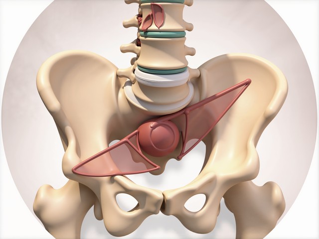 髋关节活动异常与退变关系_髋关节卡顿_髋关节训练椅