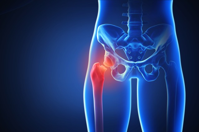 髋关节疼痛反复发作原因_髋关节训练椅_髋关节疼痛与日常活动关系