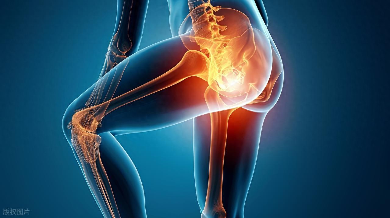 妖精漫画免费登录入口界面下拉式 髋关节疼痛不是老化？3个细节或加速退变，再忙也要改一改