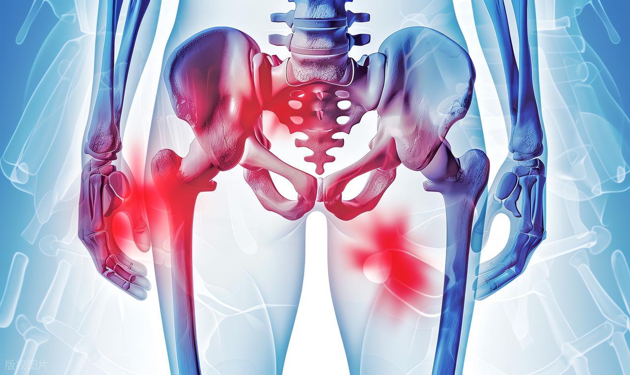 髋关节疼痛原因_加速髋关节退变细节_髋关节训练椅