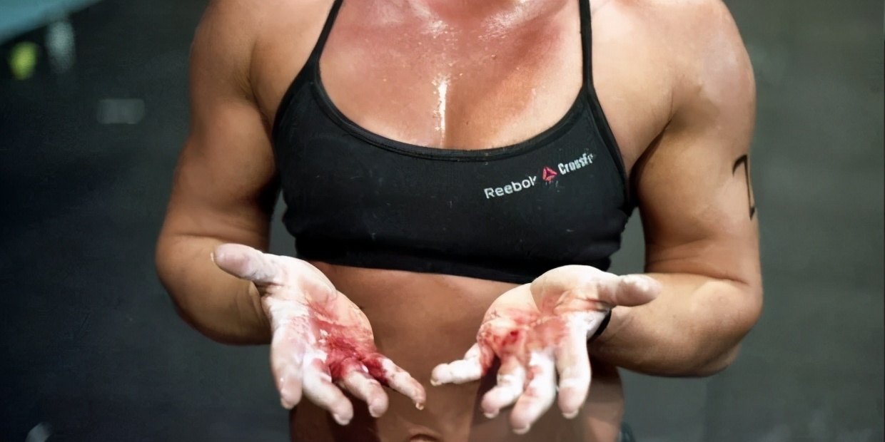 管理老茧的重要性_健身需要带手套吗_老茧形成原理