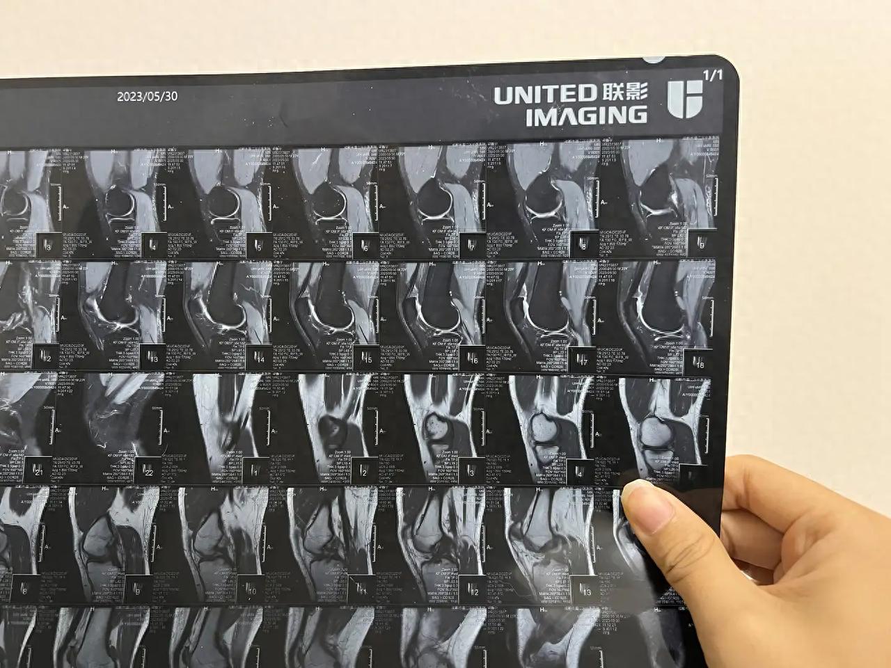 大坡度跑步机推荐_家用跑步机选购指南_网上买跑步机什么牌子好