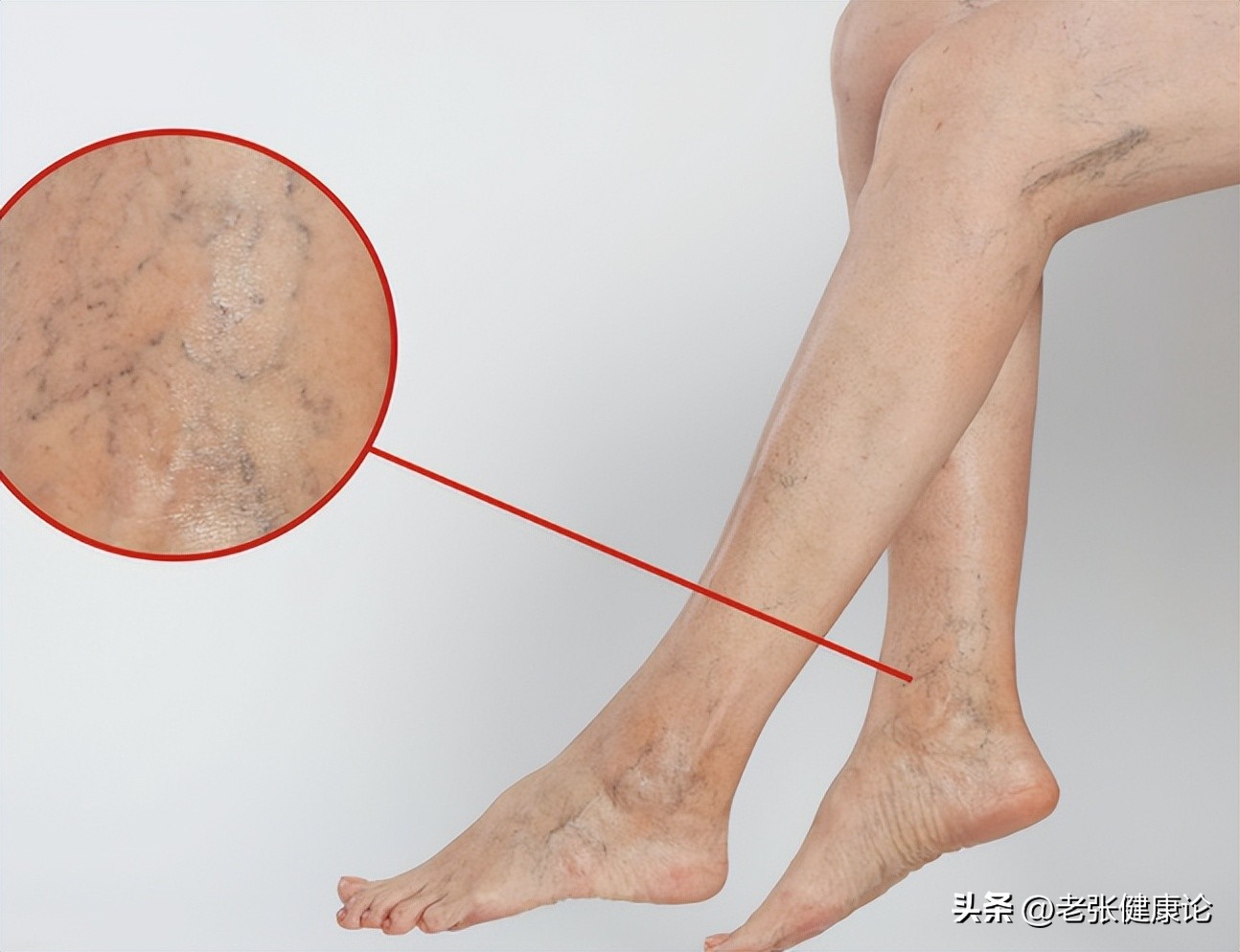 髋关节训练椅_塑料折叠凳健康风险_椅子安全隐患